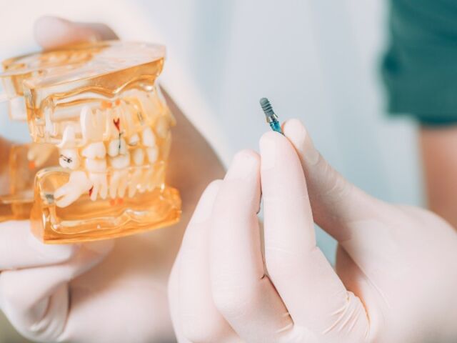 Dental professional showing a dental implant and a jaw model for educational purposes